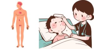 Adrenal Insufficiency Cause